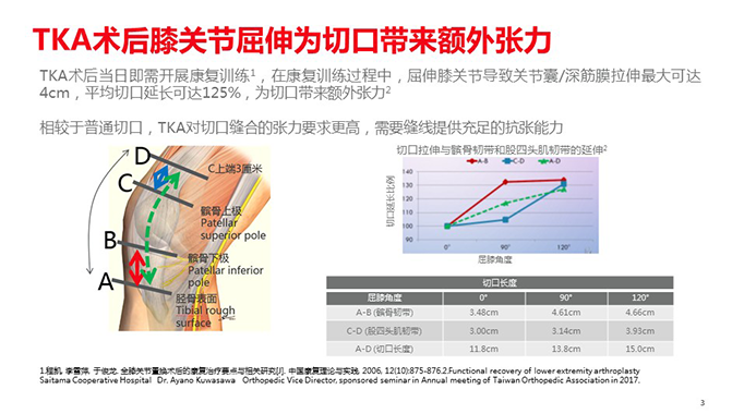 携生膝关节置换手术之鱼骨倒刺线的应用